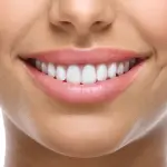 Estetica dentale: cosa fare quando si hanno dei denti brutti